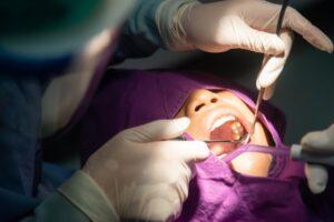 wisdom tooth extractions